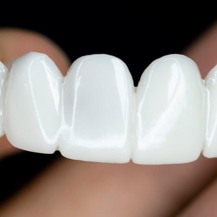 Smile Restore Dental Prosthetics with Custom Fit for Natural Confidence 3