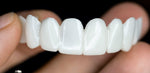 Smile Restore Dental Prosthetics with Custom Fit for Natural Confidence 3