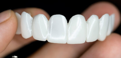Smile Restore Dental Prosthetics with Custom Fit for Natural Confidence 3