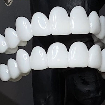 Smile Restore Dental Prosthetics with Custom Fit for Natural Confidence 4