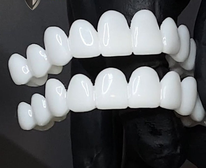 Smile Restore Dental Prosthetics with Custom Fit for Natural Confidence 4