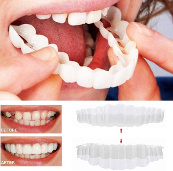 Smile Transformation | Removable Veneers Set with Natural Look | Comfortable Solution for a Perfect Smile 0