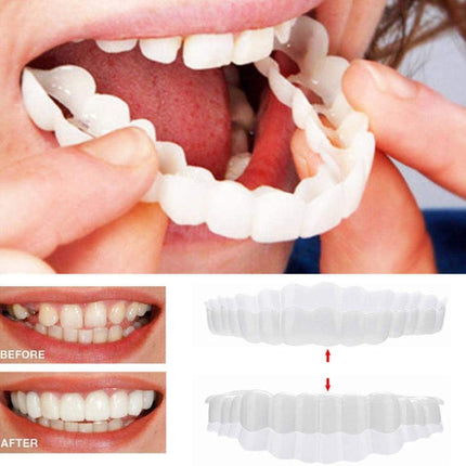 Smile Transformation | Removable Veneers Set with Natural Look | Comfortable Solution for a Perfect Smile 0