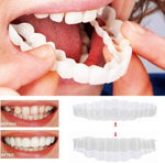 Smile Transformation | Removable Veneers Set with Natural Look | Comfortable Solution for a Perfect Smile 0
