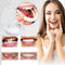 Snap-On Veneers Set for Upper & Lower Teeth with Custom Fit | Removable Solution for a Natural Smile 0