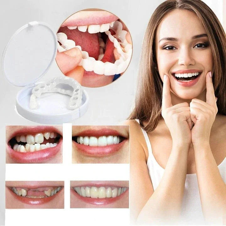Snap-On Veneers Set for Upper & Lower Teeth with Custom Fit | Removable Solution for a Natural Smile 0