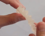 Snap-On Veneers Set for Upper & Lower Teeth with Custom Fit | Removable Solution for a Natural Smile 1