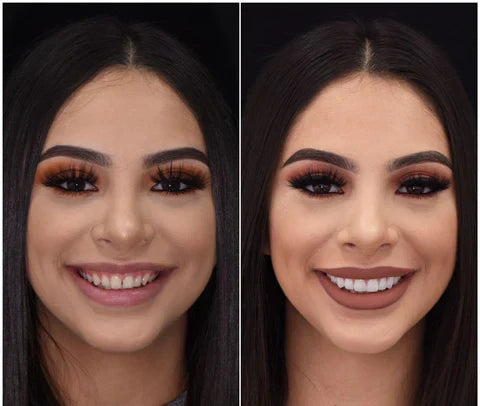 Snap-On Veneers Set for Upper & Lower Teeth with Custom Fit | Removable Solution for a Natural Smile 6