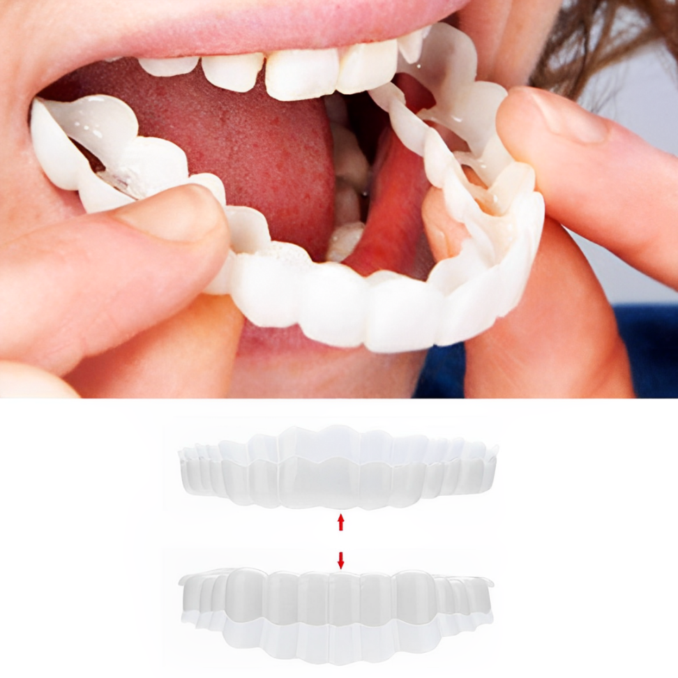 Tuzwa Clip-On Veneers – Natural-Looking Removable Cosmetic Teeth Cover for Temporary Smile Enhancement