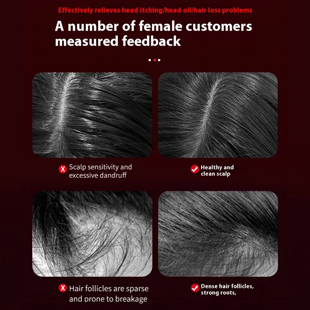 Wearclo | Scalp Massager for Hair Growth with Microcurrent & Red Light Therapy | Nourishing Treatment for Thicker Hair 3