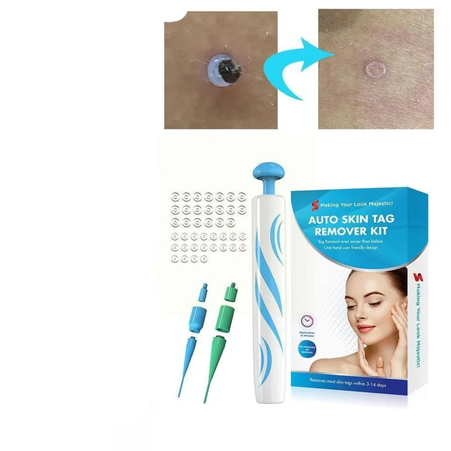 Skin Tag Remover Painless Auto Spring Kit, Skin Tag Removal Kit with Small and Large Springs, Facial Skin Tag Remover
