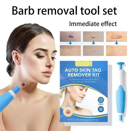 Skin Tag Removal Kit, Skin Tag Remover Pen with 40 Medical Silicone Bands – image 4