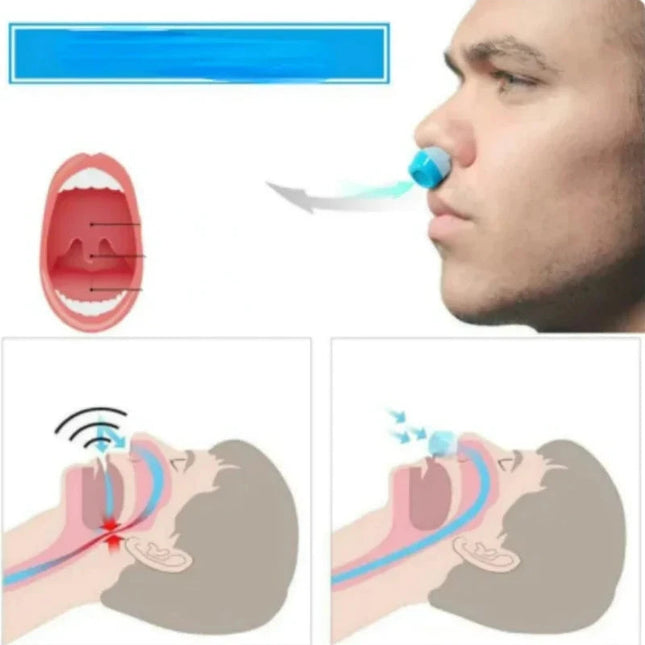Nose Clip for Snoring