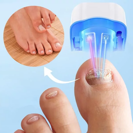 Nail Fungus Cleaning Laser Device for Toes, Compact Lightweight Portable Infrared Nail Laser for Feet – image 4
