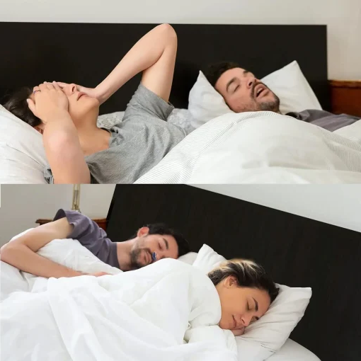 Anti Snoring Device, Rechargeable Micro CPAP Machine for Snoring and Sleep Apnea