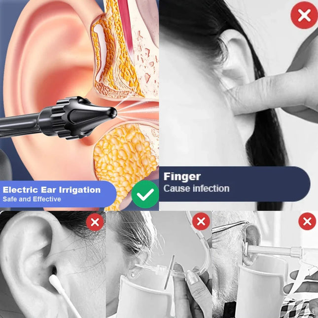 Ear Irrigator Rechargeable, Ear Cleaning Irrigation Tool with 3 Pressure Levels