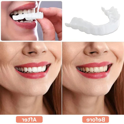 Clip On Veneers for Teeth, Natural White Finish Snap On Tooth Cover, Reusable Cosmetic Smile Set for Photos and Events