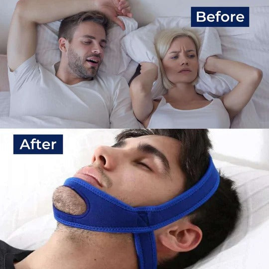 Tuzwa Chin Strap for Sleeping – Adjustable Full Head Jaw Support Strap, Lightweight One-Size Design, Blue or Black