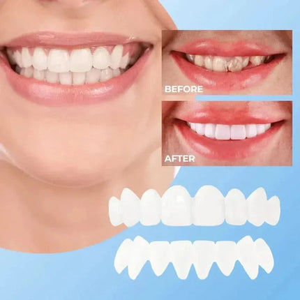 Clip On Veneers for Teeth, Natural White Finish Snap On Tooth Cover, Reusable Cosmetic Smile Set for Photos and Events
