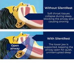 Tuzwa Chin Strap for Sleeping – Adjustable Full Head Jaw Support Strap, Lightweight One-Size Design, Blue or Black