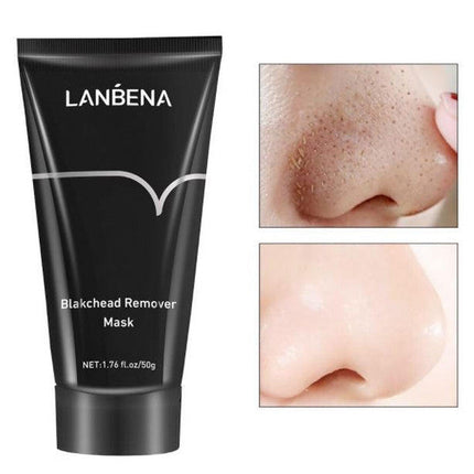 Blackhead Remover Mask with Collagen – media 7