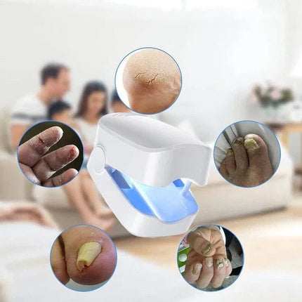 Nail Fungus Light Therapy Device, Lightweight Portable USB Charging Nail Fungus Cleaning Laser Device for Toenails (1)