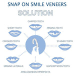 Tuzwa Clip-On Veneers – Natural-Looking Removable Cosmetic Teeth Cover for Temporary Smile Enhancement