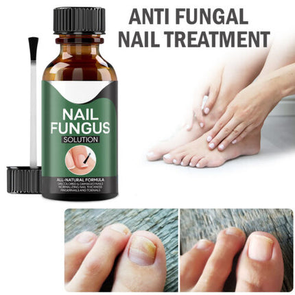 Nail Serum for Toenail Fungus, Organic Nail Care Serum for Fingernails