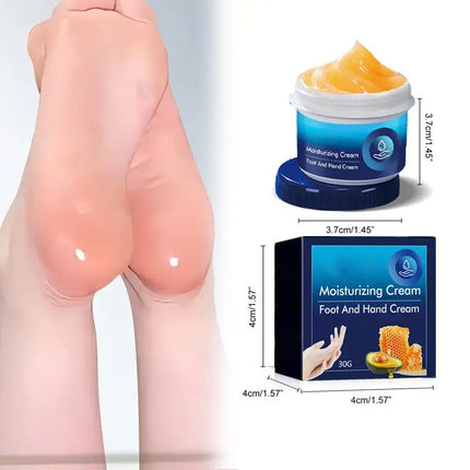 Cracked Foot Heel Treatment, Dry Skin Treatment – image 11